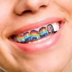 Le phénomène Tooth Art